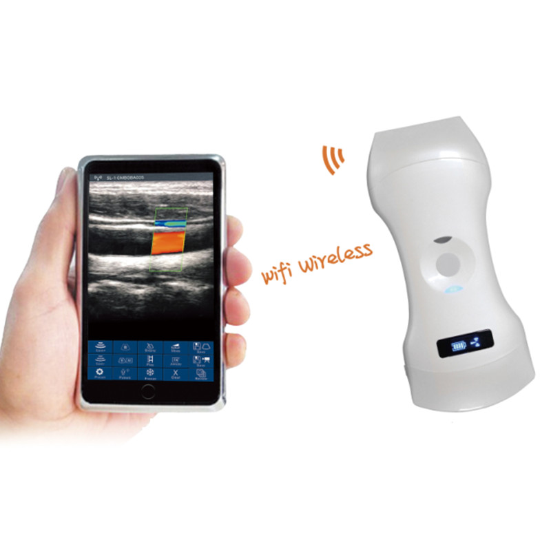 VC-3 in 1 Double Head Probe Type  Wireless Ultrasound Scanner-Double Head Probe Type  Wireless Ultrasound Scanner